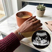 Thumbnail for Photo Projection Bracelet - From Ultrasound to Forever